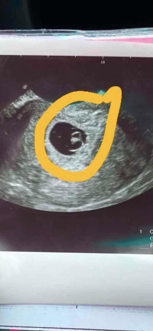 เเม่ช่วยดูหน่อยนี้ใช้น้องไหมคะ 5สัปดาห์5วัน
เเล้วจุดเล็กคืออะไรหรอคะ
ช่วยดูให้หน่อยนะคะเเม่ๆๆๆ😊