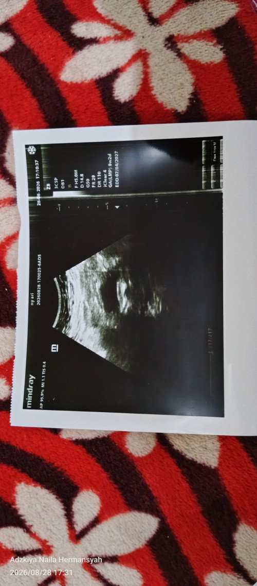 Hpht 1 juli 26