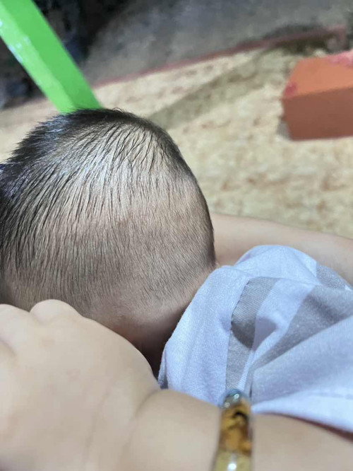 Tumgi tumbuh gigi