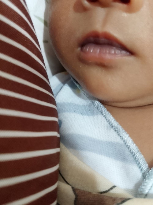 Bun mf mau tnya bayi sya bru 14 hri dan wrna bbir keunguan apkah ini krna slh pelekatan saat menyusu