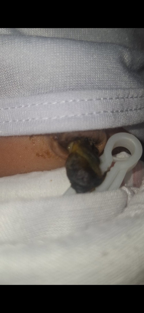 Umbilical Cord