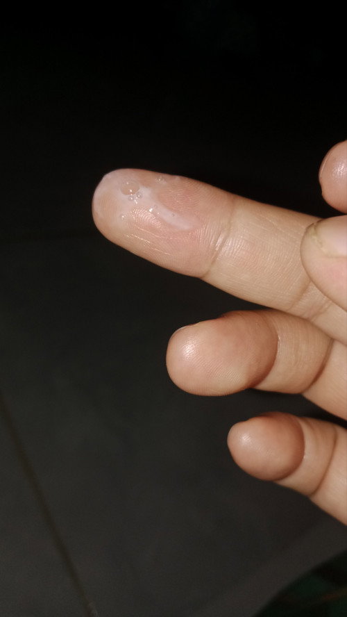 Ini lendir apa ya.?