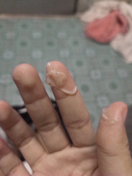 แม่แฝดรกเดียวกันคนละถุง
