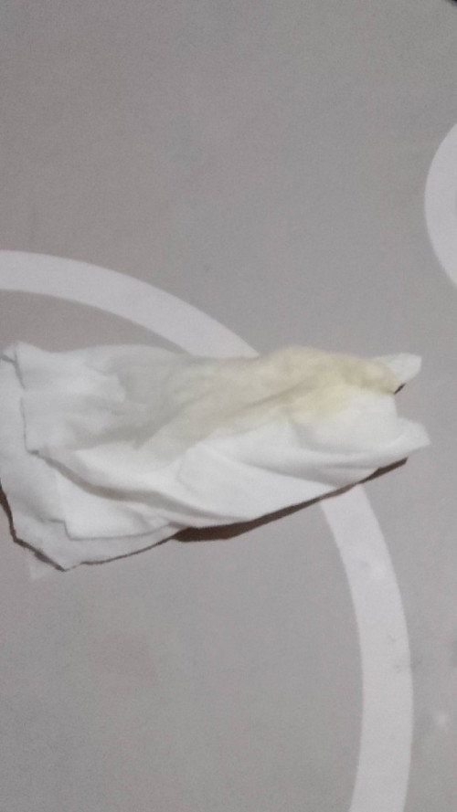 Keluar air panas2 dekat vagina. Ingatkan period sebab belum period sejak lepas habis nifas lg