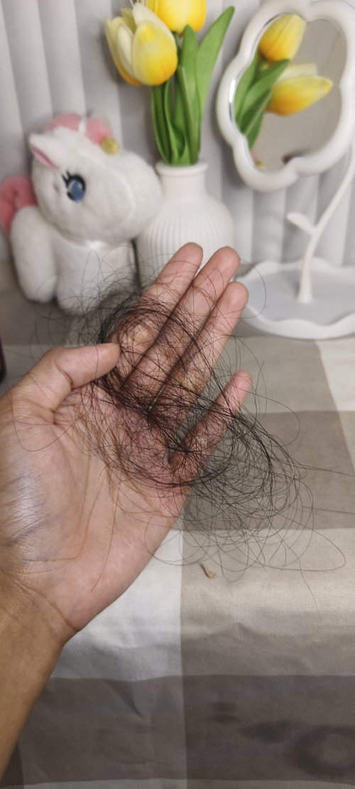 Rambut rontok selama menyusui