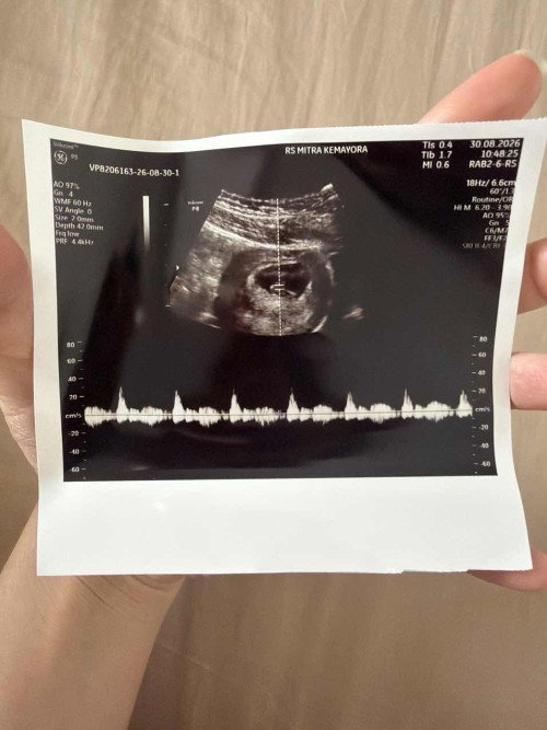 Week 8 Pregnant