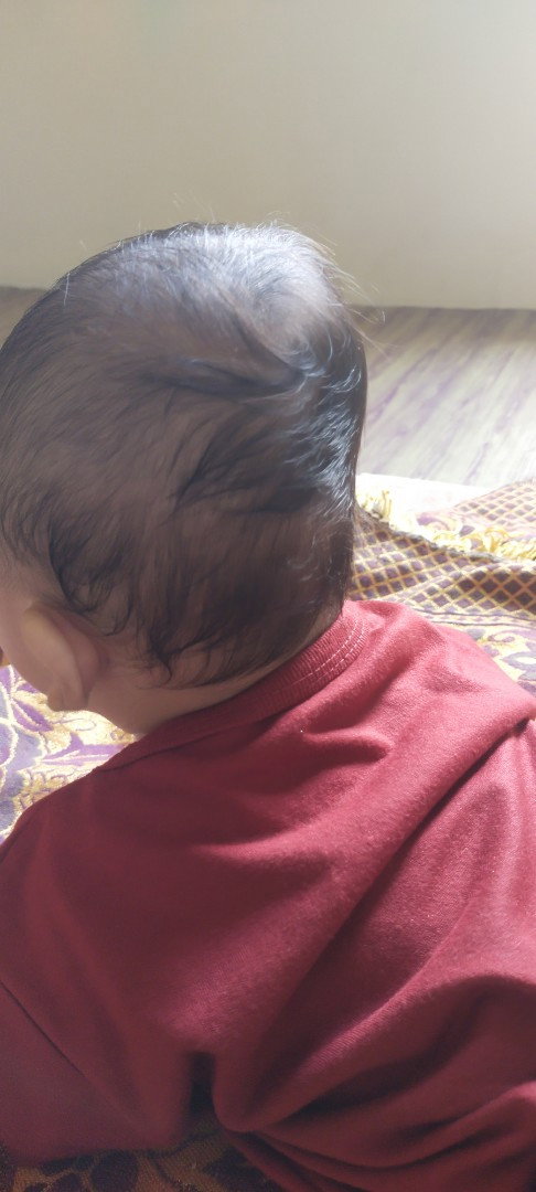 Kepala Anak