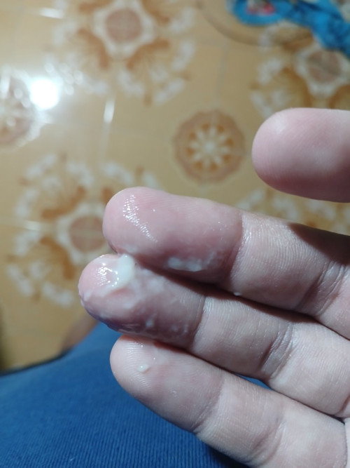38+1 แบบนี้มูกหรือตกขาวคะ