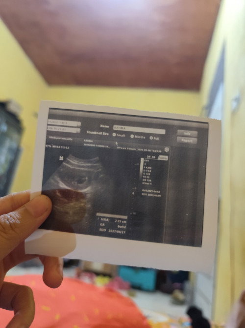 Keluar darah segar