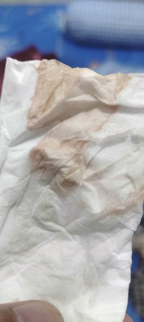 Keluar flek coklat