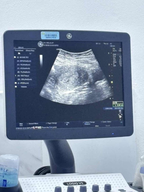 Kisah usg breast absess bkunjung ke usg prgnnt😅