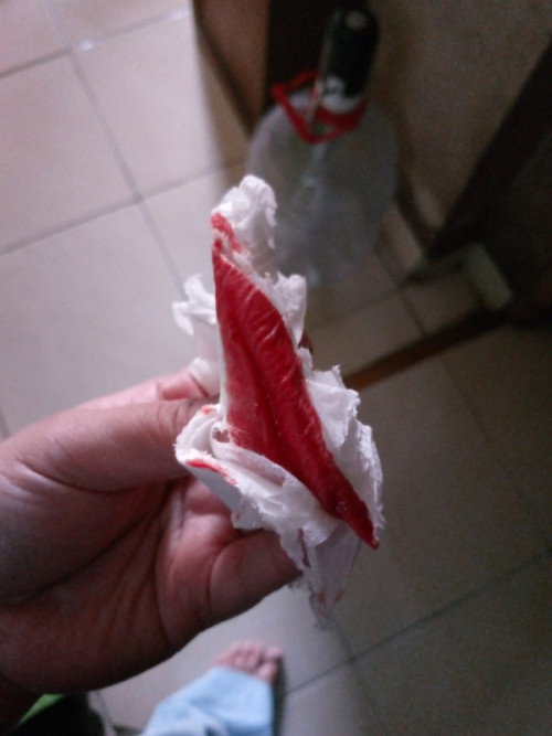 Hamil usia 10 Minggu