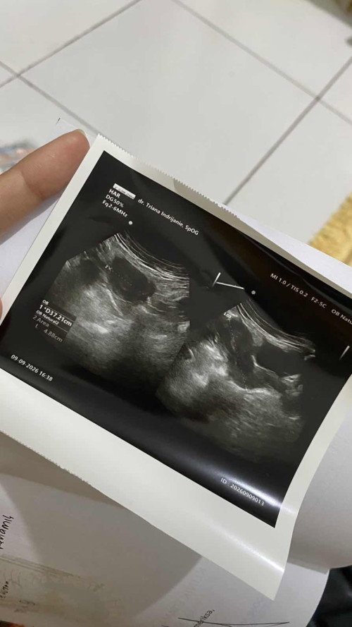Hamil 4weeks what to do ?