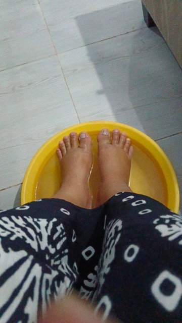 Bunda saya 35 w 3 hr kaki dan tangan saya bengkak sakit seperti abis jatuh...