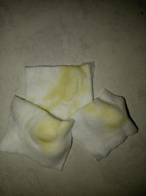 Keluar cairan usia 35 minggu