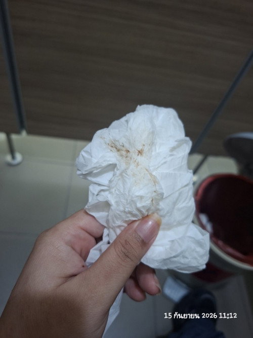 ตกขาวขึ้นแบบนี้ปกติมั้ยค่ะ ตอนนี้กังวลมากค่ะ