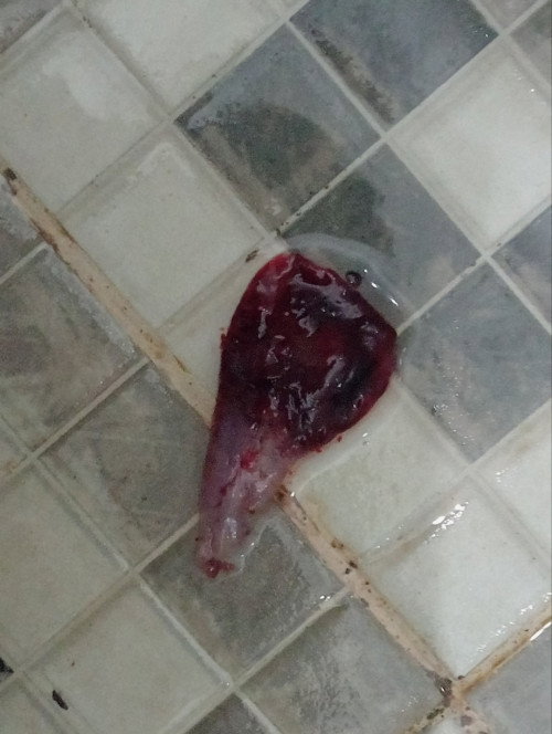 apakah ini keguguran???