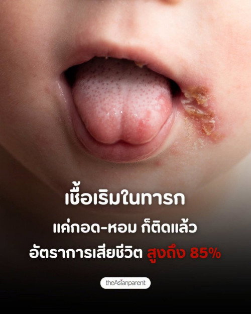 เชื้อเริมในเด็ก แค่กอดหอม ก็ติดได้แล้ว อัตราเสียชีวิตสูงถึง 85%