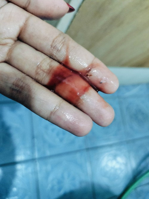 Keluar lendir darah di tm 1 setelah HB keluar di dalam