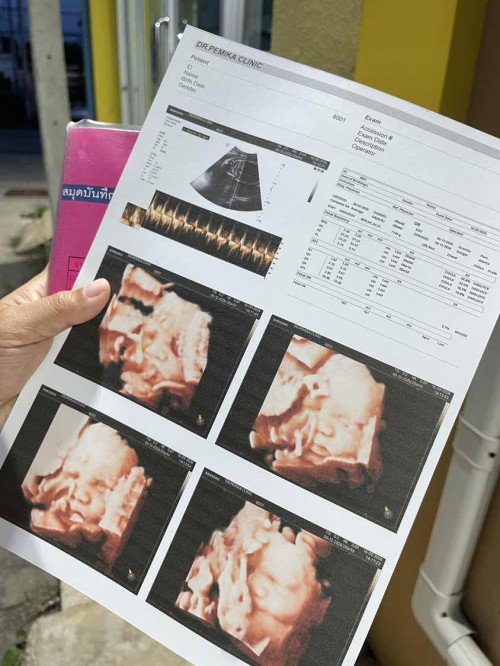 28 week แล้วครับแม่แม่