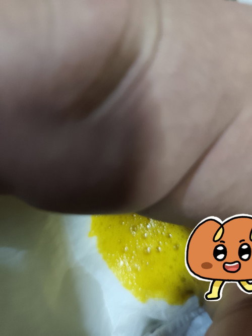 Najis baby 1 bulan