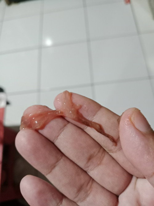 Keluar lendir darah