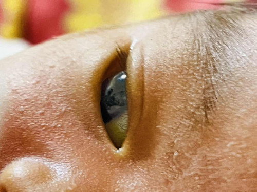 Yellowish Eyes