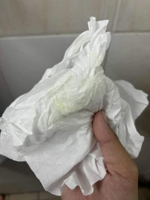 เเบบนี้คือเมือกไหมคะ