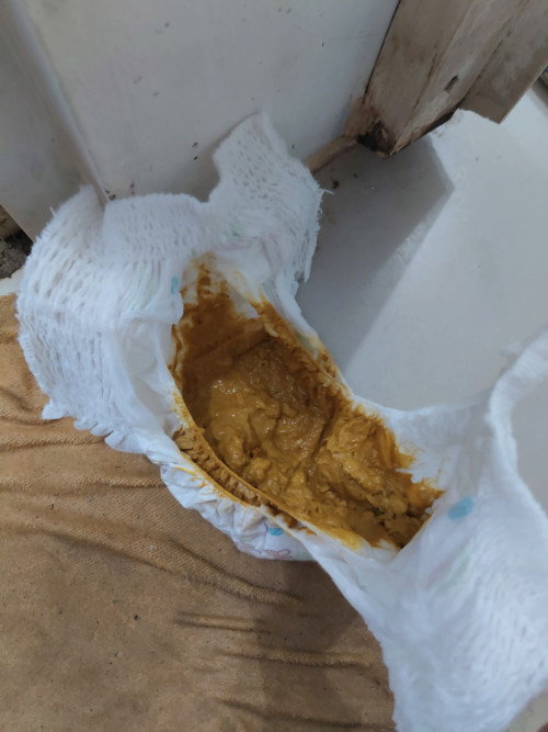 Bab anak dari lahir sampai sekarang 2 tahun tidak bertekstur. Berbentuk bubur terus bab 1xsehari