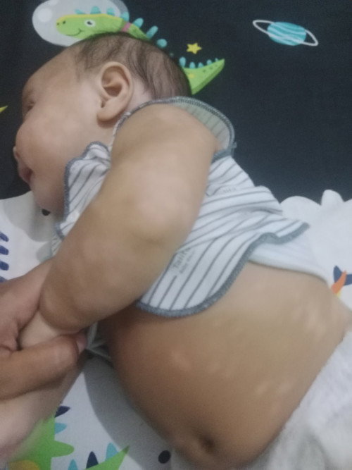 Bercak putih