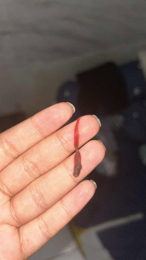 Kak aku hamil anak pertama izin saling berbagi pengalamannya