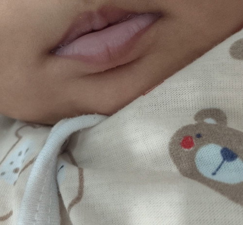 Bibir putih