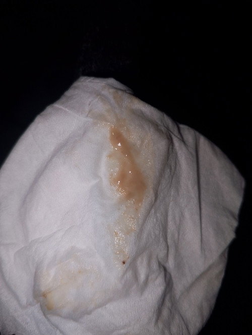 apakah ini flek?