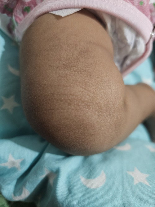 SKIN COLOR O LIBAG/DEAD SKIN?
