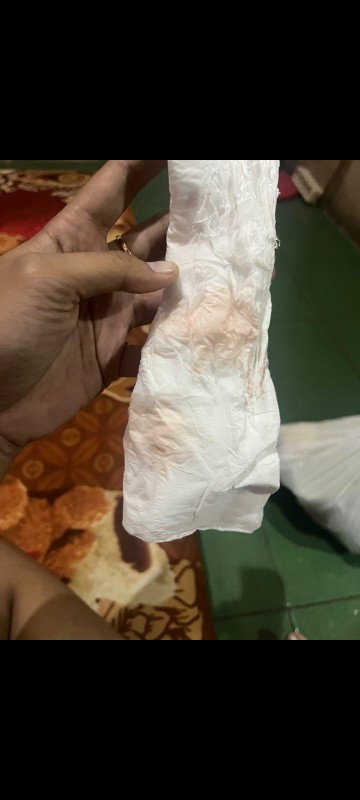 Hamil 4 Minggu 5 hari kluar flek dan perut kram apa gapapa bim sharing yg punya cerita sama bun