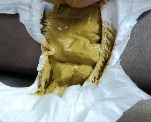 Baby berak hijau dan cair