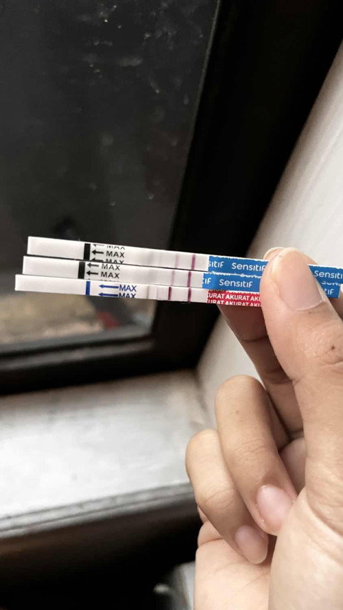 usg pertama