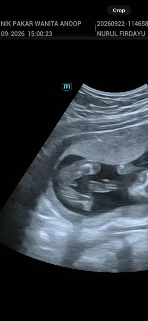 boy or girl