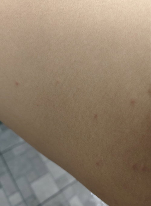 แม่ตั้งครรภ์