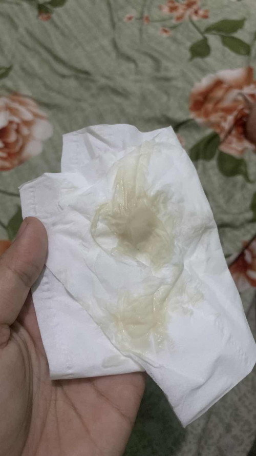 kehamilan 6 minggu