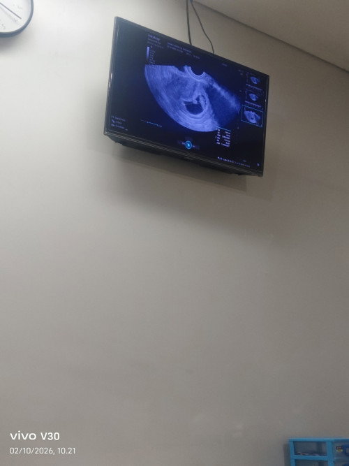Usia 8minggu