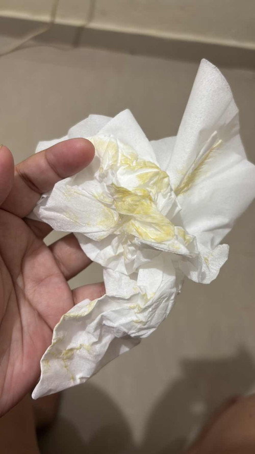 Keluar cairan agak kuning dari miss v
