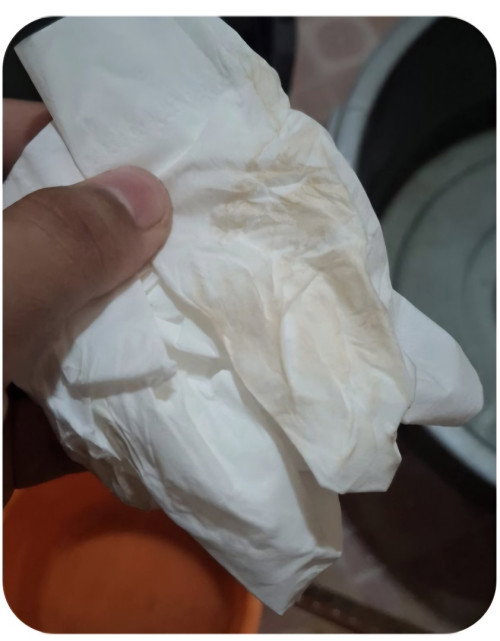 Mau tanya ini di kehamian 36 w 3 d