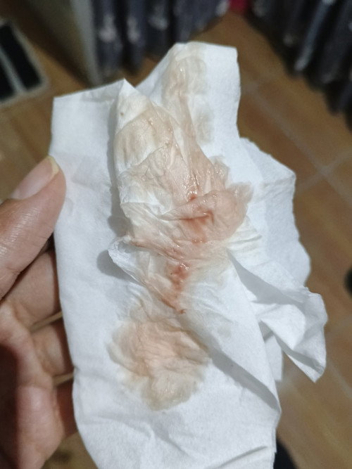 Hpl 15okt keluar lendir darah