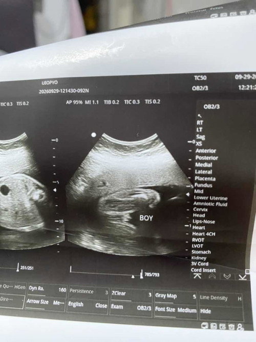 Gender reveal