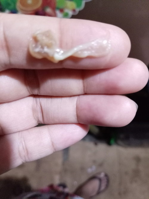Flesh Skin sa Pwerta.