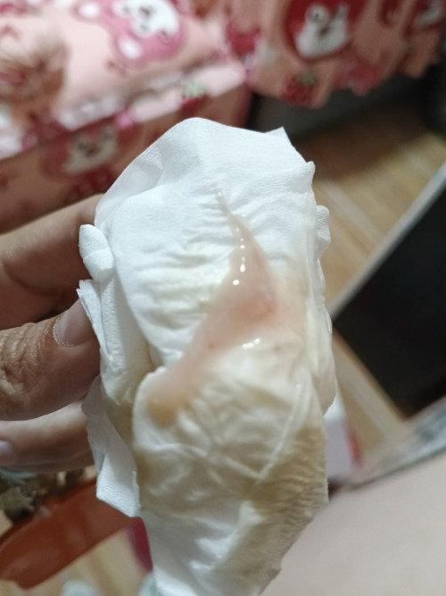 Lendir darah di 38week