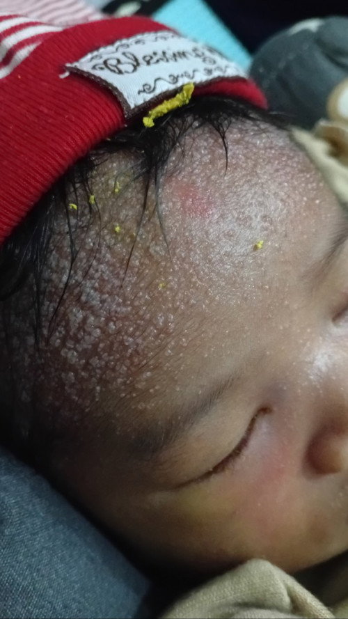 Bayi 10 hari