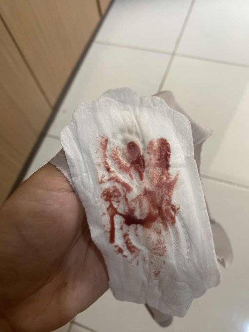 Riwayat keguguran 1x
Tiap hamil selalu flek
