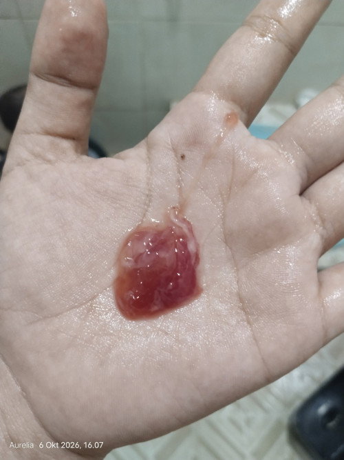 Ini tanda2 lahir kah bun ? Soalnya anak pertama ga kluar gini, langsung pecah ketuban lngsung lahir.